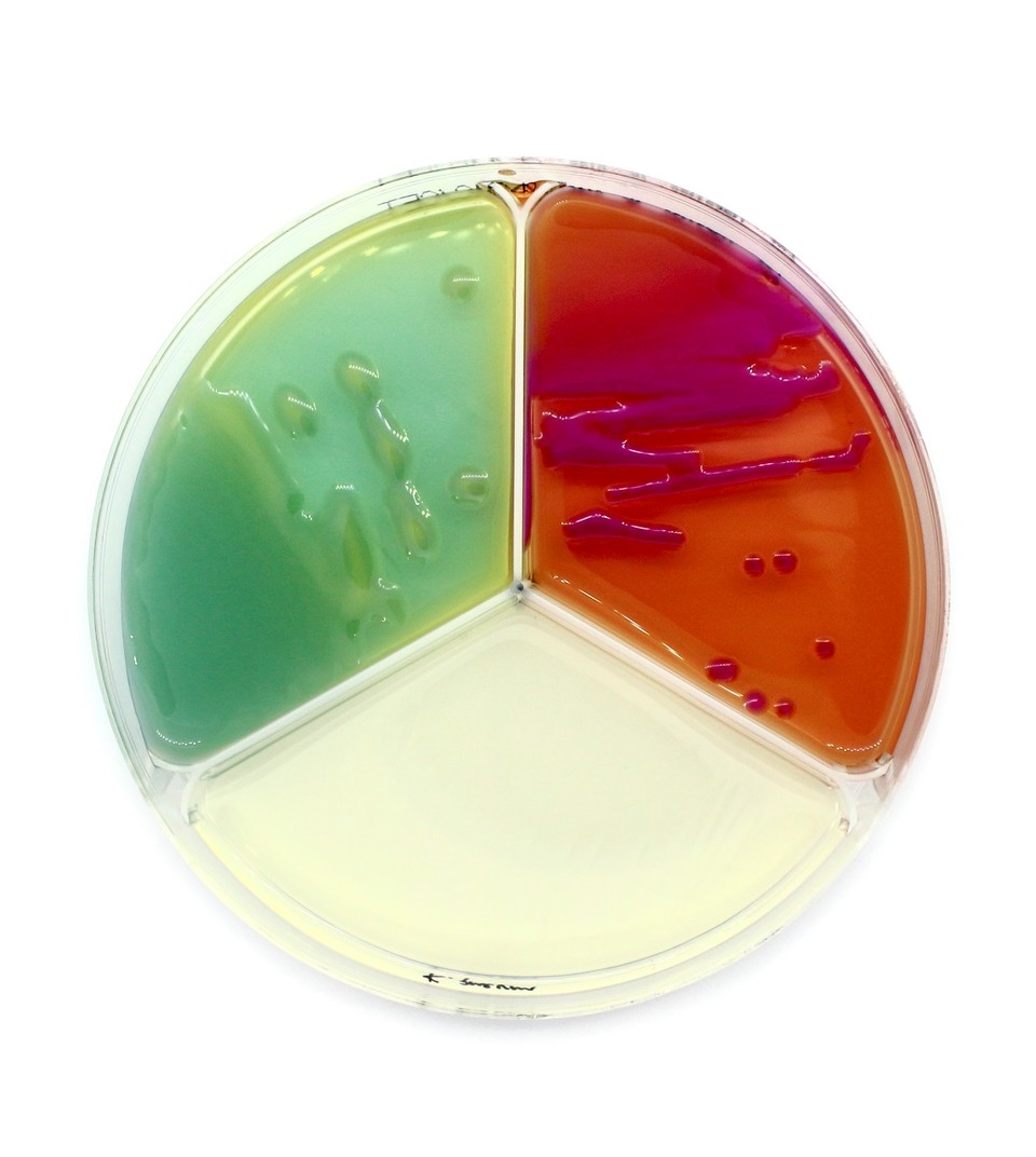 3 sector agar plates