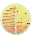 2 sector agar plates