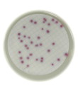 60 mm agar plates